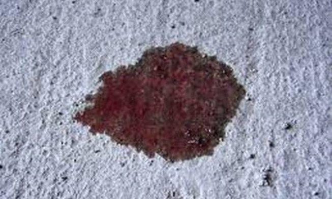 Prevent and Fix Power Steering Fluid Leak img